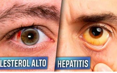 6 Enfermedades que tus ojos pueden revelar