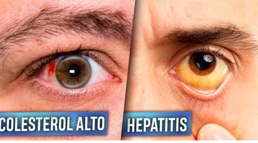 6 Enfermedades que tus ojos pueden revelar